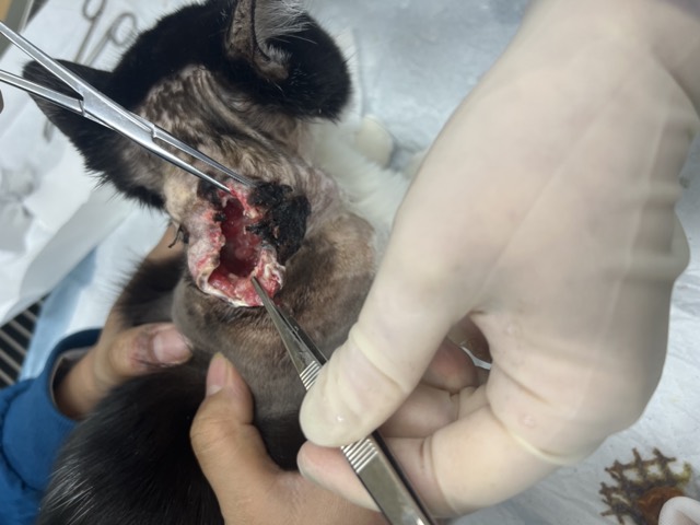 Large-Area Skin-Muscle Separation & Ulceration: Skin-muscle separation, skin necrosis