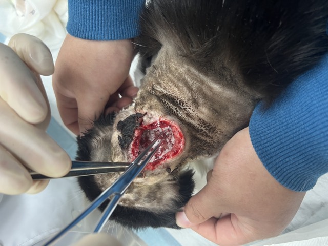 Large-Area Skin-Muscle Separation & Ulceration: Two bottles of ECM Antibacterial Powder packed