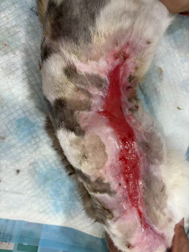 Large-Area Burn (approx. 40cm): 3rd application