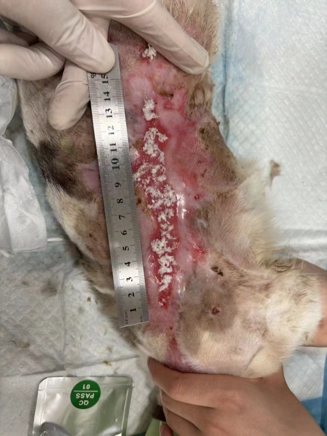 Large-Area Burn (approx. 40cm): 4th application