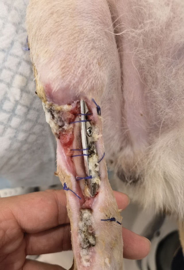 Post-Orthopedic-Surgery Infection: After 1 application cycle