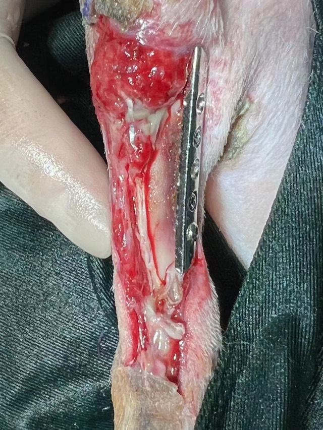 Post-Orthopedic-Surgery Infection: During dressing change / application