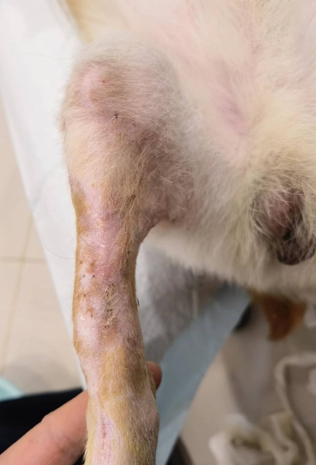 Post-Orthopedic-Surgery Infection: Fully recovered