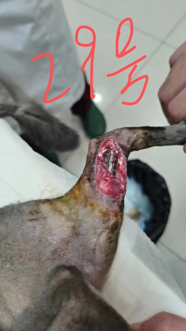 Orthopedic Infection with Soft-Tissue Loss: Wound bright red, entered granulation phase
