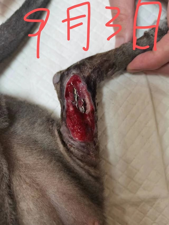 Orthopedic Infection with Soft-Tissue Loss: Granulation growth significant
