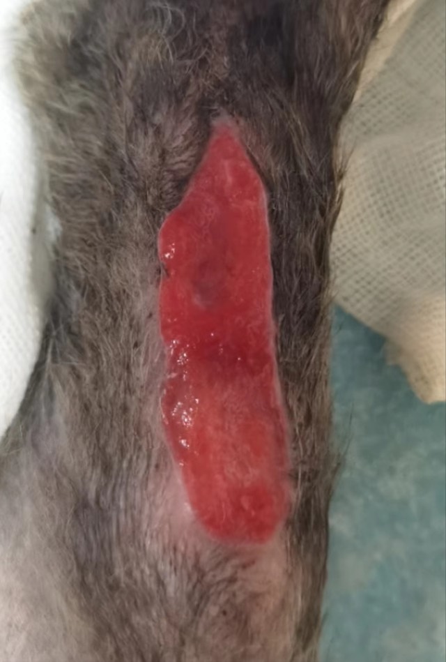 Orthopedic Infection with Soft-Tissue Loss: Skin started growing