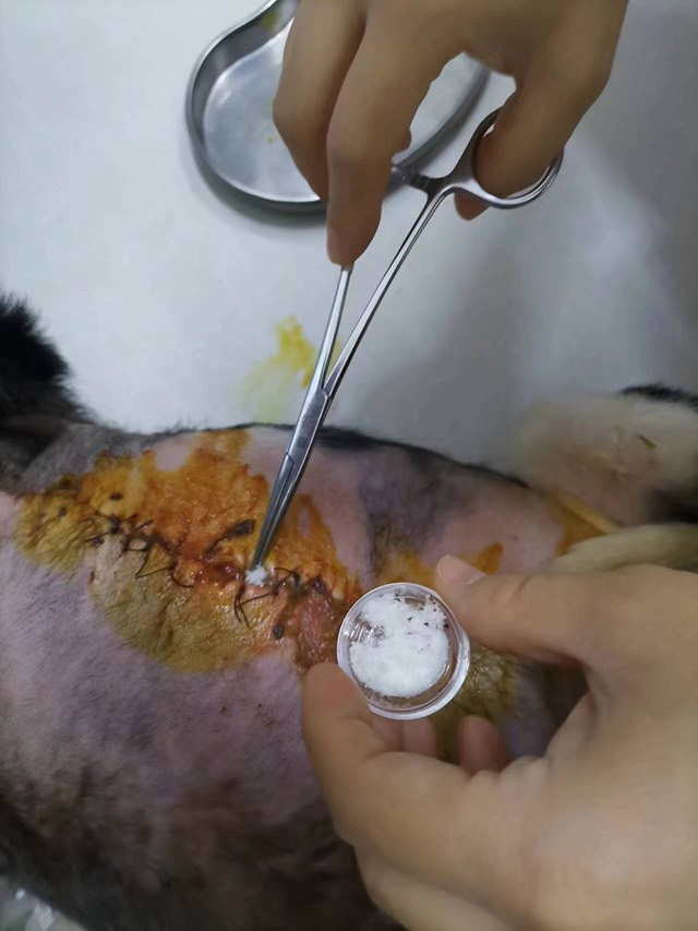 Non-Healing Wound after Mastectomy: Powder applied subcutaneously and on surface