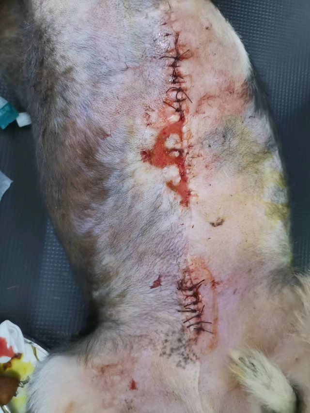 Non-Healing Wound after Mastectomy: Basically cured