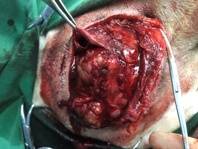 Tumor-Resection Cavity Filling: ECM Sponge implanted (cavity filling)