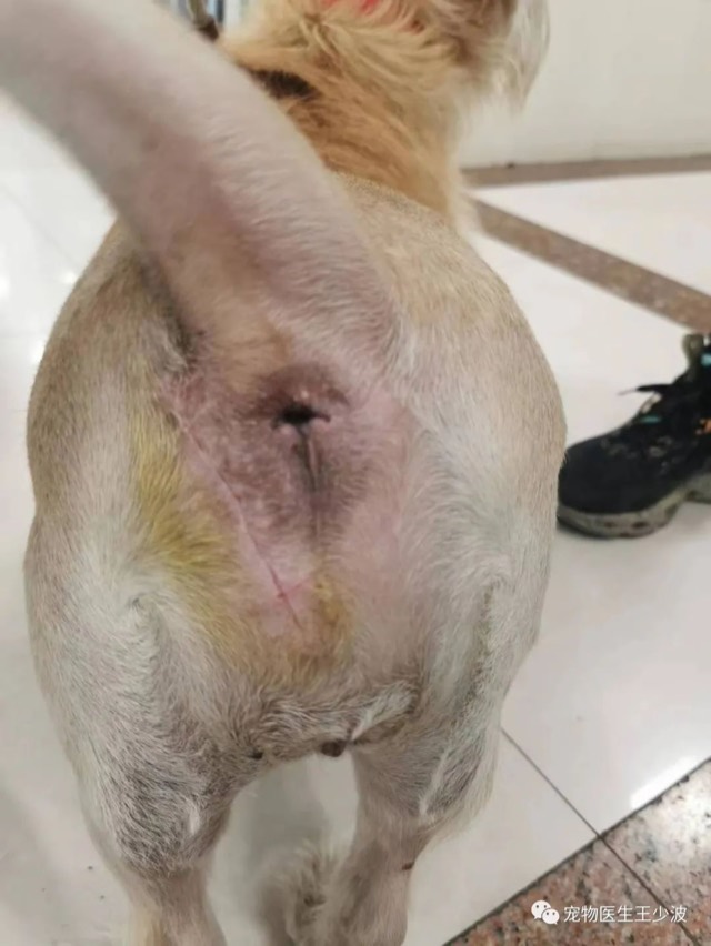 Tumor-Resection Cavity Filling: Wound closed