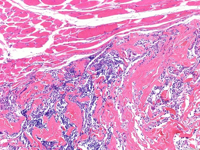 ECM Sponge In-Vivo Fate Follow-up: In-vivo fate X-ray follow-up