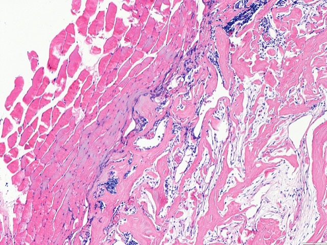 ECM Sponge In-Vivo Fate Follow-up: In-vivo fate X-ray follow-up