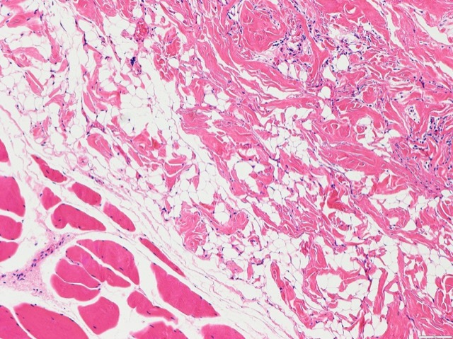 ECM Sponge In-Vivo Fate Follow-up: In-vivo fate X-ray follow-up