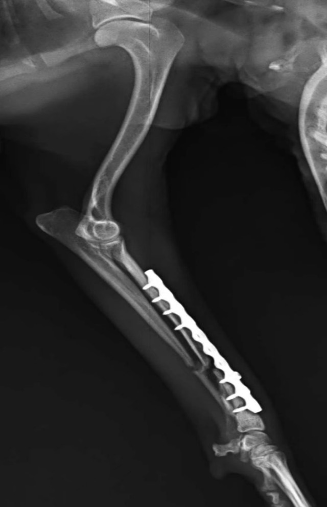 Post-Op Radial/Ulnar Bone Dissolution (Case 1): 30-day re-check post-op: bone dissolution