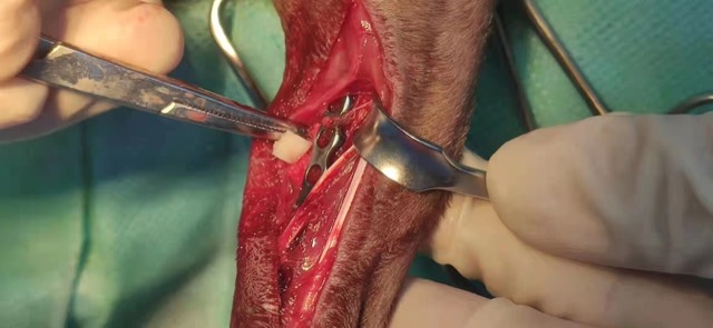 Post-Op Radial/Ulnar Bone Dissolution (Case 1): Surgery opened, Antibacterial Artificial Bone applied
