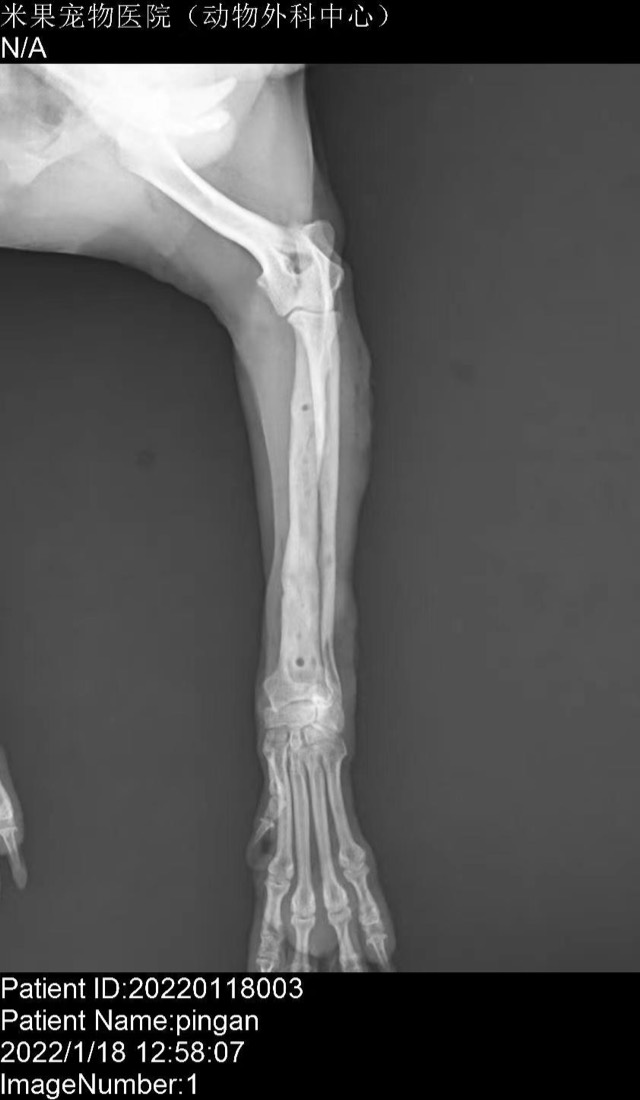 Post-Op Radial/Ulnar Bone Dissolution (Case 1): All plates removed, good healing