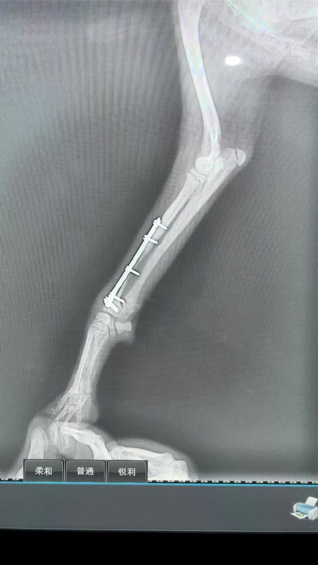 Post-Op Radial/Ulnar Bone Dissolution (Case 2): Missed plate-removal time, bone dissolution