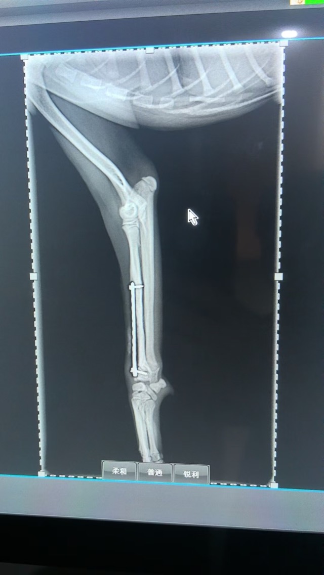 Post-Op Radial/Ulnar Bone Dissolution (Case 2): Bone grew rapidly