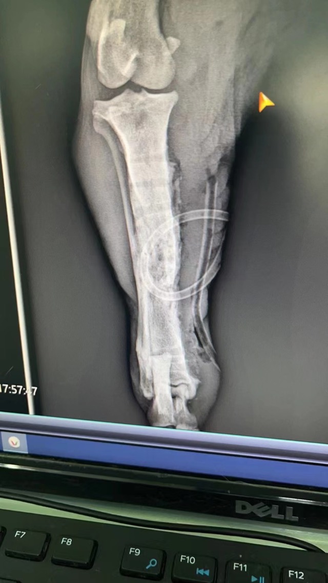 Old Comminuted Fracture Revision: Plate removed, movement recovered as before