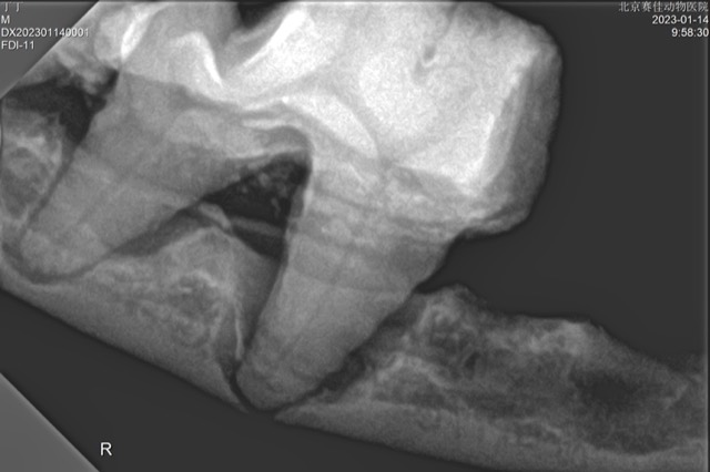 Tooth Extraction and Alveolar Bone Reconstruction: Antibacterial Artificial Bone granules filled