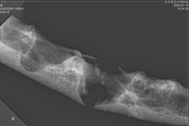 Tooth Extraction and Alveolar Bone Reconstruction: X-ray: mandibular dissolution defect