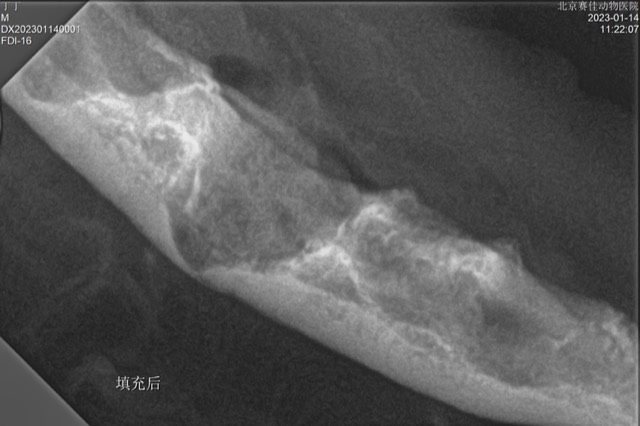 Tooth Extraction and Alveolar Bone Reconstruction: X-ray after filling