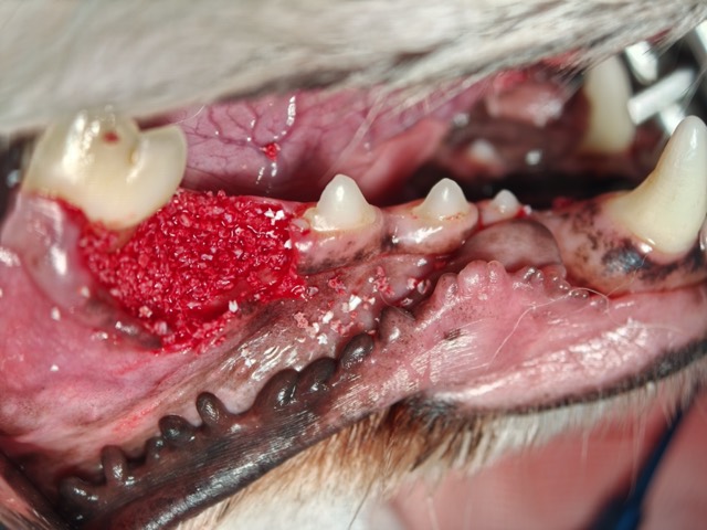 Standard Four Steps of Alveolar Bone Reconstruction: Fig.2 Antibacterial Artificial Bone filled