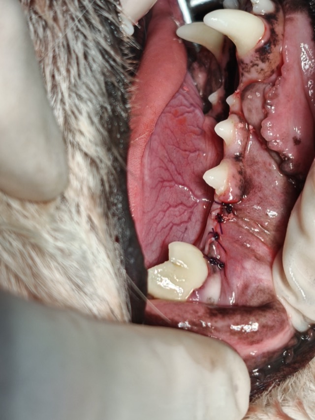 Standard Four Steps of Alveolar Bone Reconstruction: Fig.4 Gingiva sutured