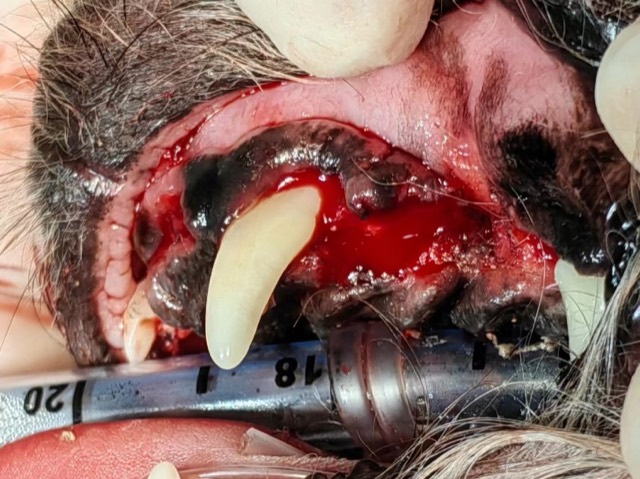 Periodontal GTR Guided Regeneration (Tooth-Saving): Mucosal flap reflected
