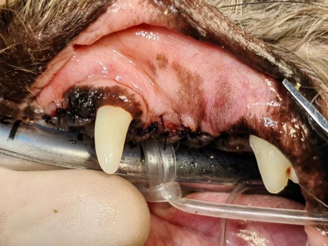Periodontal GTR Guided Regeneration (Tooth-Saving): Tension-free nodular suture
