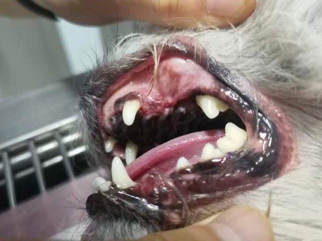 Periodontal GTR Guided Regeneration (Tooth-Saving): Sutures removed at 10 days, good recovery