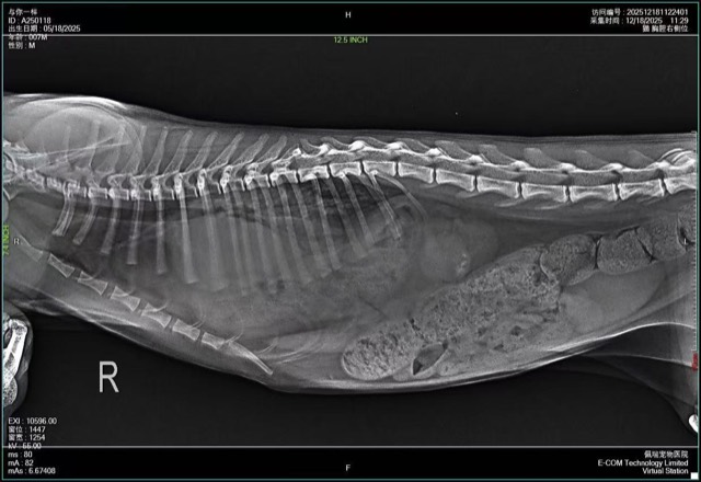 Diaphragmatic Hernia Repair: X-ray: typical diaphragmatic hernia image