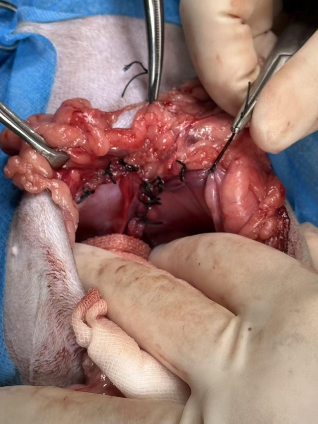 Diaphragmatic Hernia Repair: Mesh repair