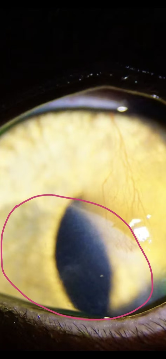 ECM Antibacterial Powder Corneal Application: Covered area fully healed, clear boundary