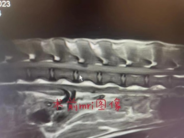 Hemilaminectomy (Disc Fenestration): Hemilaminectomy (disc fenestration)